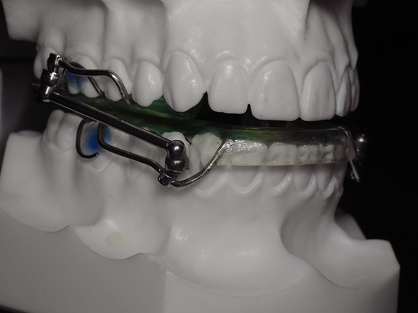 Réduction de la taille des pivots et des armatures